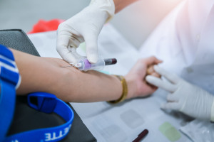 Cada 3 o 5 años. A partir de hoy, un nuevo programa y pruebas gratuitas en el Fondo Nacional de Salud. Básico y avanzado [LISTA]