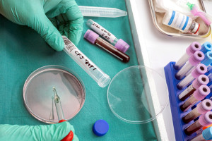 Pacientes com doenças raras são submetidos a