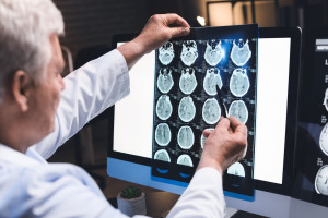 New gene therapy could change Alzheimer's treatment