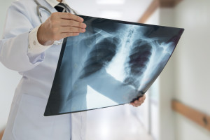 173 personas bajo supervisión. Brote de tuberculosis en guarderías y jardines de infancia.