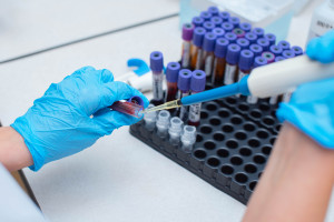HCV- en hiv-behandeling voor mensen zonder verzekering. Het ministerie van Volksgezondheid presenteerde een project.