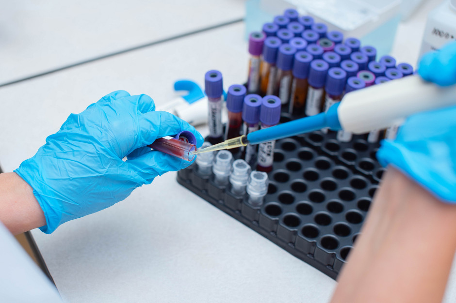 Leczenie HCV i HIV dla osób bez ubezpieczenia. MZ przedstawił projekt