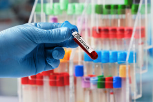 What if everyone with high cholesterol took medication? That's how many people would live
