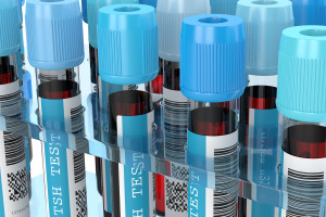 An endocrinologist on the program's pitfalls