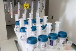 Experts: a molecular test more effective than cytology is reimbursed by the National Health Fund