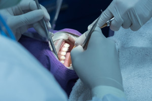 Dental treatment before surgery. Tax office clarifies tax relief.