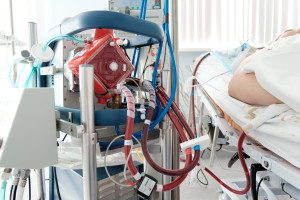 A global success for doctors from the Medical University of Warsaw. 48 days on ECMO and a liver transplant. This is how they saved an 18-year-old boy.