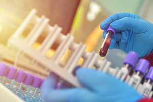 Paciente tratado ambulatorialmente sem possibilidade de biópsia líquida