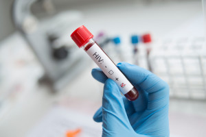 E quanto ao tratamento do HIV para quem não tem plano de saúde? Fundo Nacional de Saúde (NFZ): Sem uma fonte de financiamento clara, essa é uma tarefa impossível.